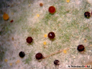 Mogyoró lisztharmat kazmotéciumai (80x nagyításban)